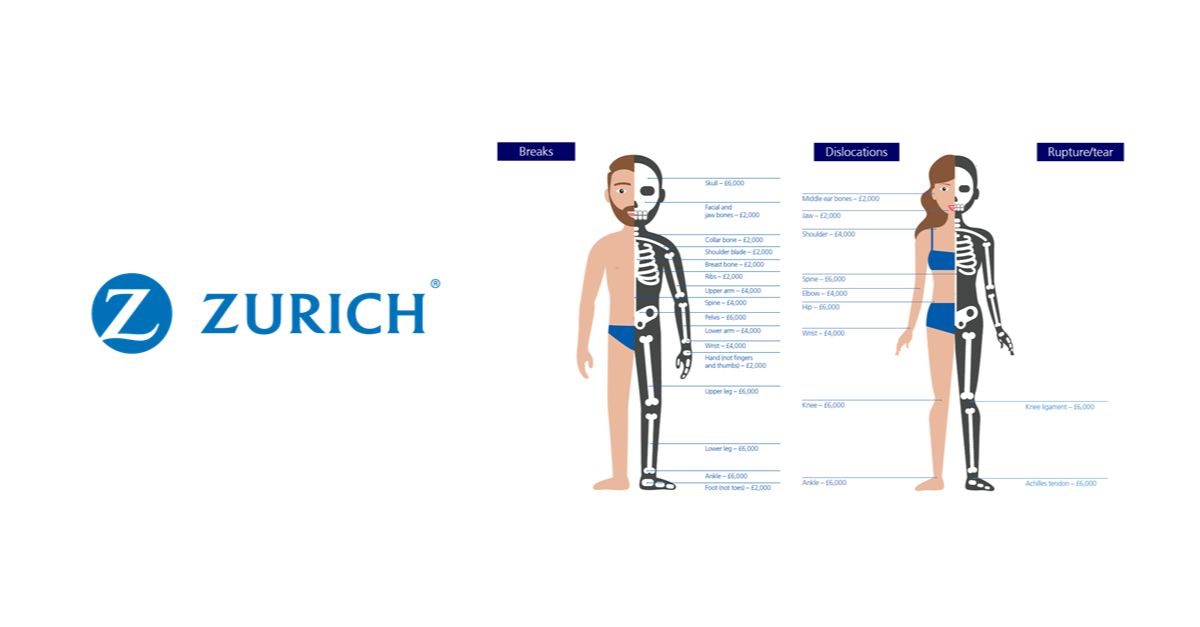 Zurich’s Claims Stats highlight Fracture cover is not just for active clients