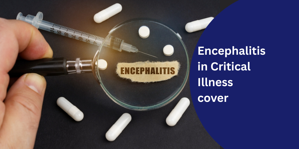 Encephalitis in Critical Illness cover