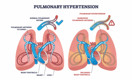 Pulmonary hypertension in Critical Illness cover