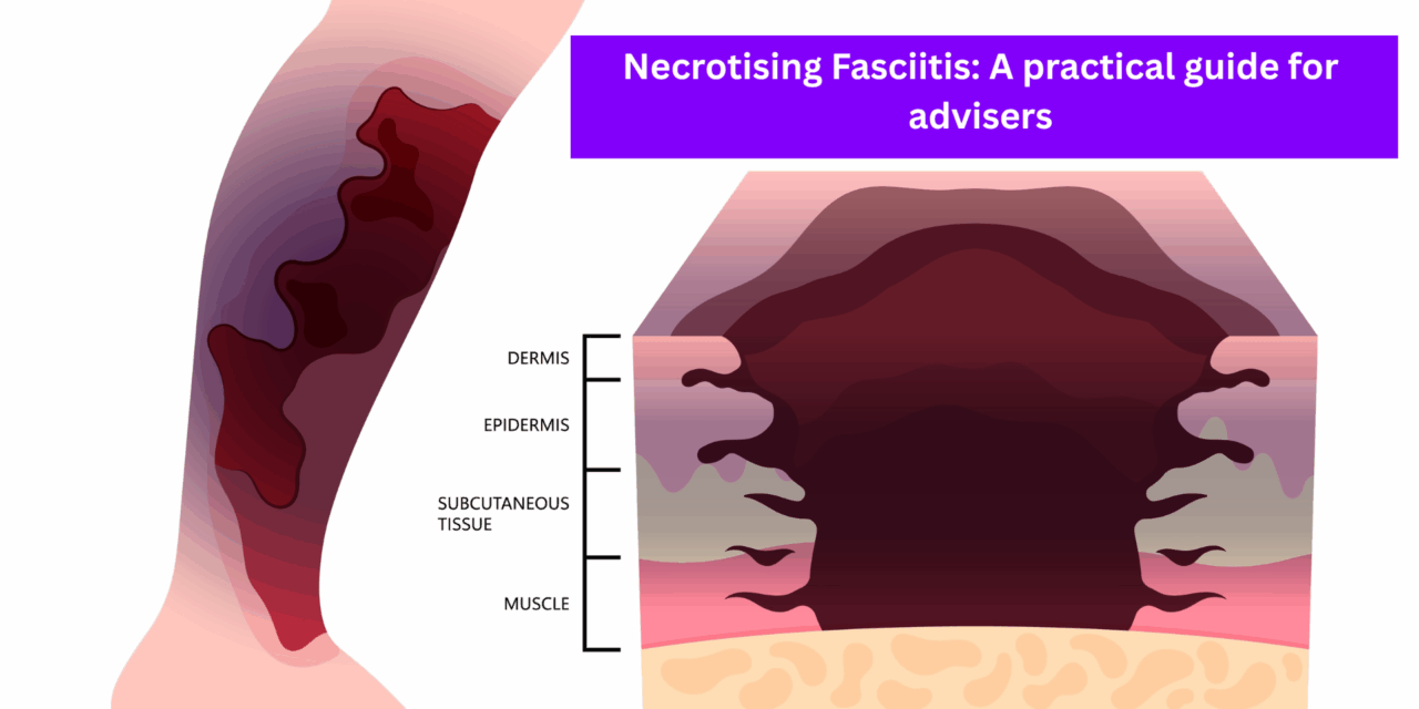 Necrotising Fasciitis: A practical guide for advisers