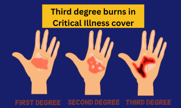 Third degree burns in Critical Illness cover